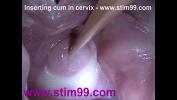 Video porn Insertion Semen Cum in Cervix Wide Stretching Pussy Speculum online - xTeenPorn.Net