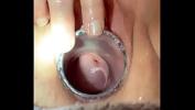 Watch video sex Watch cervix appear as tight pussy takes oversized speculum Mp4