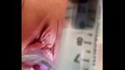 Watch video sex new as cervix painfully dilated w catheter Mp4